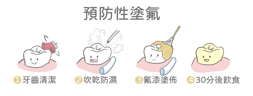 塗氟